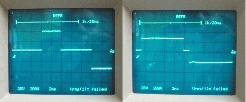 image sinus modifié ou pseudo sinus